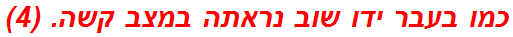 כמו בעבר ידו שוב נראתה במצב קשה. (4)